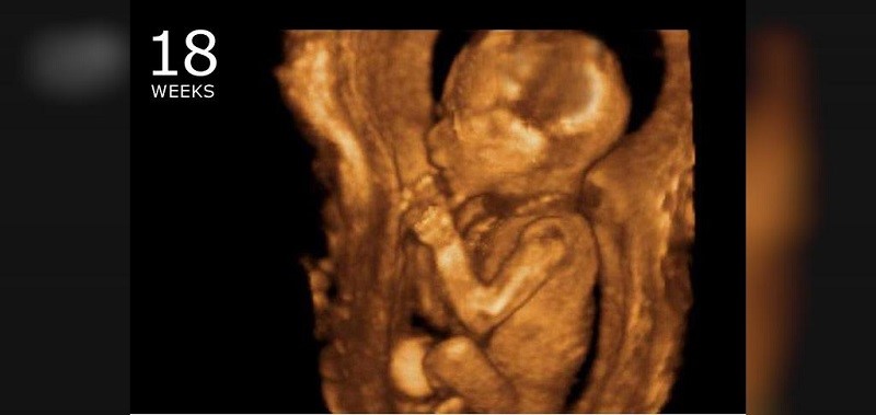 سونوگرافی در هفته هجدهم بارداری